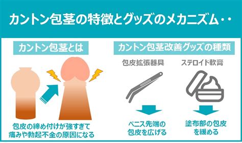 かんとんほう|カントン包茎は自力で治すことはできる？原因と特徴。